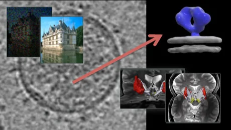 Image and Video Processing: From Mars to Hollywood with a Stop at the Hospital オンライン講座